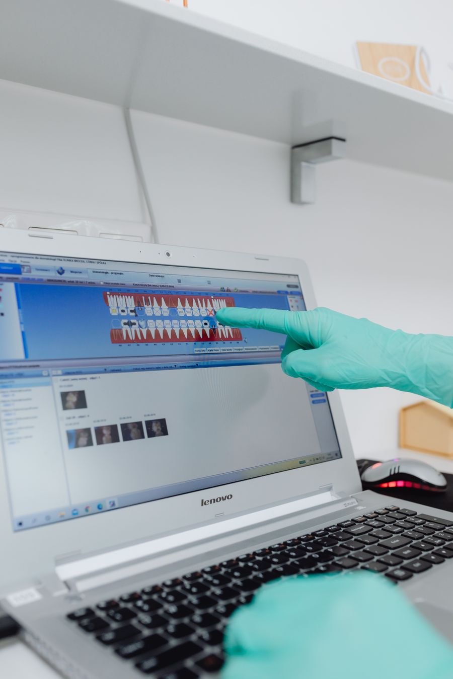 A patient chart on a laptop in a dental practice